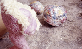 Wool - Tumeur I, 1972    