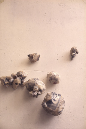 Les Petits Tumeurs [Małe Nowotwory], 1969 